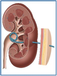 Chimiothérapie Urgence