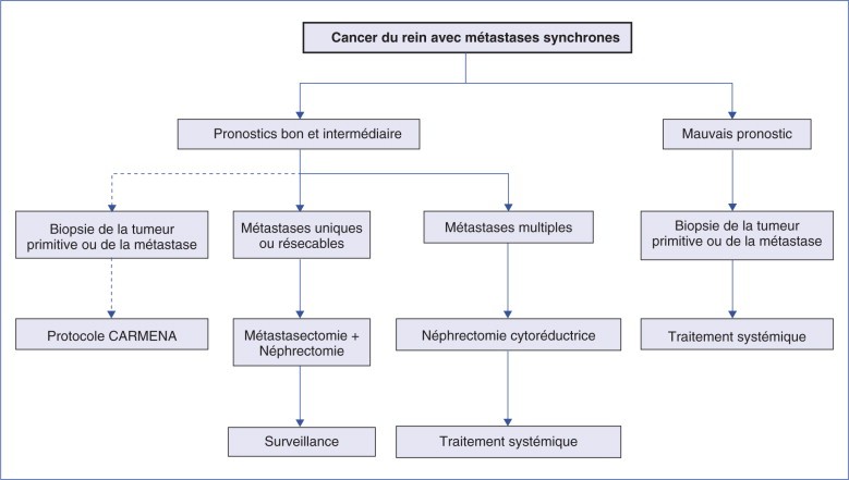 Most cancers Rein Radiotherapie